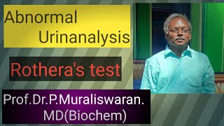 Rotheras test Muralis Simplified Biochemistry [upl. by Alaunnoif217]