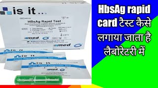 HbsAg rapid card test  hepatitis B surface antigen  HbsAg test  medical laboratory [upl. by Oirad]