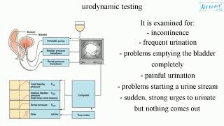 urodynamic testing [upl. by Nylednarb454]