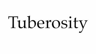 How to Pronounce Tuberosity [upl. by Eniamerej]