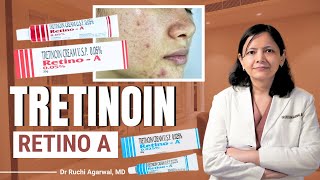 Tretinoin cream  Tretinoin Cream for Acne  Tretinoin cream 005  Dr Ruchi Agarwal  tretinoin [upl. by Eibbob697]