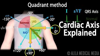 Cardiac Axis Interpretation Animation [upl. by Eecram701]