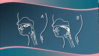 Chapter 3  Understanding Cleft LipPalate Physiology [upl. by Schlessinger678]