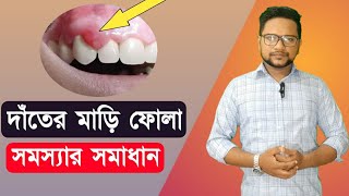 দাঁতের মাড়ি ফুলে গেলে করণীয়। দাঁতের মাড়ি ব্যথা কমানোর উপায়। দাঁতের মাড়ি ফুলে যাওয়া। Dater mari fola [upl. by Chaddy]