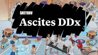 Ascites Diagnosis Causes amp DDx Guide Part 1  Sketchy Medical  USMLE Step 2 CK [upl. by Pegeen]