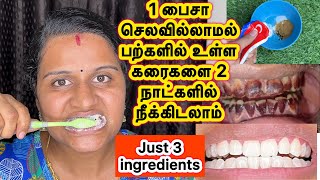 Teeth whitening at homeWhitening teeth home RemediesHow to whiten teethbhuvana pandi lifestyle [upl. by Sayre]