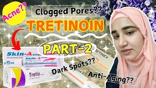 Skin Transformation using tretinoin  How did I clear my skin using tretinoin  Tretinoin Benefits [upl. by Enaffit676]