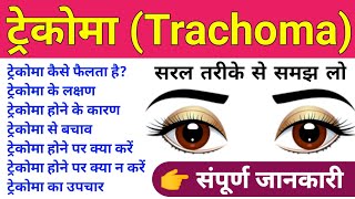 Trachoma Disease in Hindi  Trachoma Causes Symptoms Treatment Prevention  ट्रेकोमा रोगबीमारी [upl. by Serena]