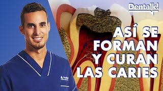 EVITA LAS CARIES – Causas PREVENCIÓN y tratamiento de la caries dental  Dentalk © [upl. by Anelrahc]