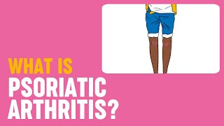 What is psoriatic arthritis [upl. by Markus]