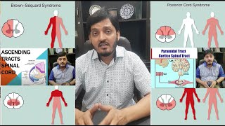 Spinal Cord Injuries  NeuroAnatomy  Rules Facts Clinical Features  Muhammad Kamran Ameer [upl. by Anerbes618]