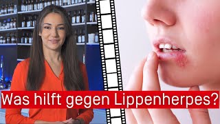 Was hilft gegen Lippenherpes [upl. by Aisilef116]