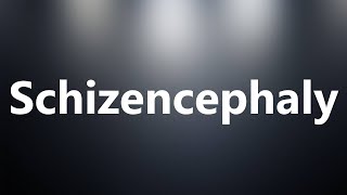 Schizencephaly  Medical Meaning and Pronunciation [upl. by Attenwahs213]