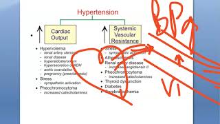 Medicine 531 Secondary Hypertension High Blood Pressure Causes Primary difference Liddle syndrome [upl. by Kolva]