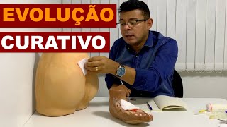 Evolução  Curativo [upl. by Noinatrad]