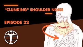 “Clunking” shoulder sound [upl. by Nikal]