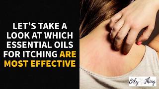 5 Best Essential Oils for Itching Solutions You Can Try Today [upl. by Scharaga]