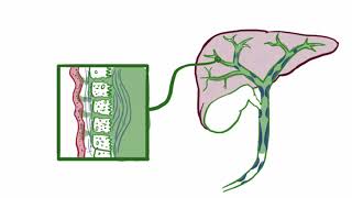 Primary sclerosing cholangitis causes symptoms diagnosis treatment amp pathology [upl. by Clay]