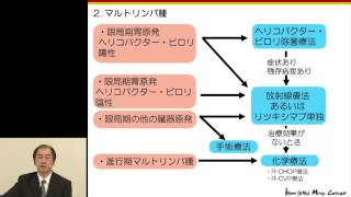 No6 悪性リンパ腫の治療について 福島 伯泰 [upl. by Atekram]