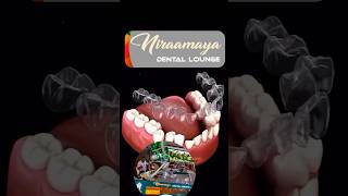 Clear teeth aligners Niraamaya Dental Lounge Alamcode Attingal Varkala Aligners dentalclinic [upl. by Signe]