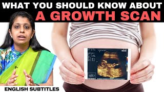 Growth Scan In Pregnancy  கரு வளர்ச்சி ஸ்கேன் பற்றி நீங்கள் தெரிந்து கொள்ள வேண்டிய விஷயங்கள் [upl. by Ahsoj]