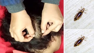 Lice Picking ASMR  Hair Care amp Treatment Sounds [upl. by Hannahsohs]