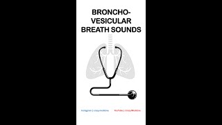 Bronchovesicular Breath Sounds [upl. by Ajiam]