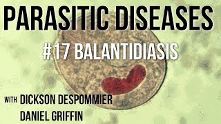 Parasitic Diseases Lectures 17 Balantidiasis [upl. by Emiolhs]