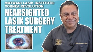 Nearsighted Myopia LASIK Surgery Treatment [upl. by Ahsenom511]