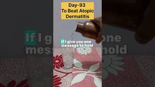 Day93 To Beat Atopic Dermatitis✅️ [upl. by Abeh]