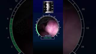 Inside the Womb  Fetal Growth of a Baby WeekbyWeek  नौ महीने का अद्भुत जीवन😇 baby development [upl. by Bab]