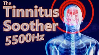 Tinnitus Soother is MidRange Focused 5500Hz Noise [upl. by Htenaj]