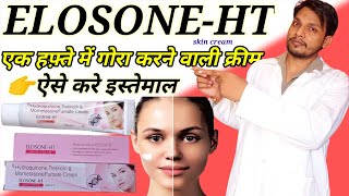 Hydroquinone tretinoin mometasone furoate cream  Elosone Ht cream useside effects in hindi [upl. by Dicky808]