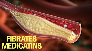 pharmacology  Hyperlipidemia and Antihyperlipidemic Drugs Fibrates [upl. by Yrak]