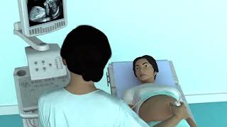 The Basic Steps of an Obstetric Ultrasound Examination [upl. by Acinorev338]