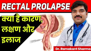 Rectal Prolapse Causes Symptoms and Treatmentdrramakantsharma7 [upl. by Akimert]