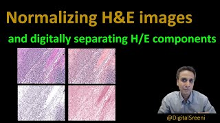 122  Normalizing HampE images and digitally separating Hematoxylin and Eosin components [upl. by Yvon]