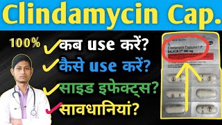 Clindamycin capsule 300 mg  Acne pimplesमुहासो की बेस्ट दवा  Clinfamycin  Dalacin c 300mg [upl. by Egiaf]