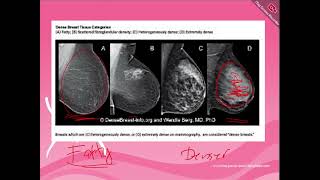 Mammography 1 [upl. by Mixam]