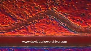 Inflammatory Response in Tissue 1 [upl. by Archibald]