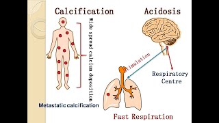 Acidosis alkalosis and calcification [upl. by Christmas]