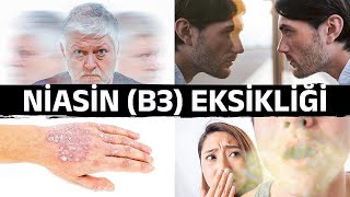 Niasin B3 Eksikliğinin Şaşırtıcı Belirtileri  Dr Berg Türkçe [upl. by Anada]