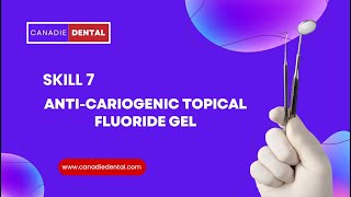 Skill 7Anti Cariogenic Topical Fluoride Gel [upl. by Zeidman]