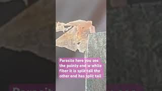 fungus spore mold skin flukes morgellons myjourney skin condition ulcer help share win [upl. by Solraced]