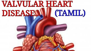 Valvular heart disease in tamil class medics [upl. by Anoy]