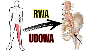 RWA UDOWA  ból pleców i drętwienie nogi  Ćwiczenia  ciekawostka 🧐 [upl. by Kentigerma59]