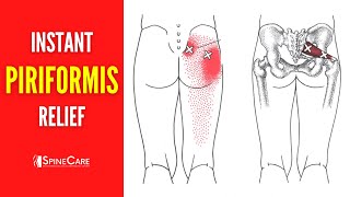 How to Get Rid of Piriformis Pain FOR GOOD [upl. by Eniaj]