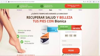 Bionica Mexico  Varicose Reduces pain in the feet [upl. by Ydal]