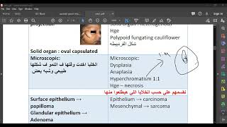 L25 Pathology Salivary Gland Tumors 1 [upl. by Finah836]