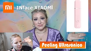 XIAOMI INFACE  Peeling Ultrasónico [upl. by Grover582]